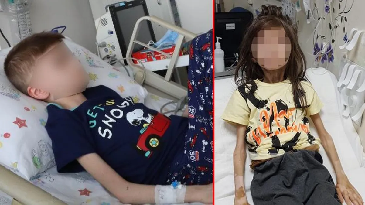 Çöp evde bulunan Muhammet’ten sevindiren haber: Yürüyor, 2 kilo aldı